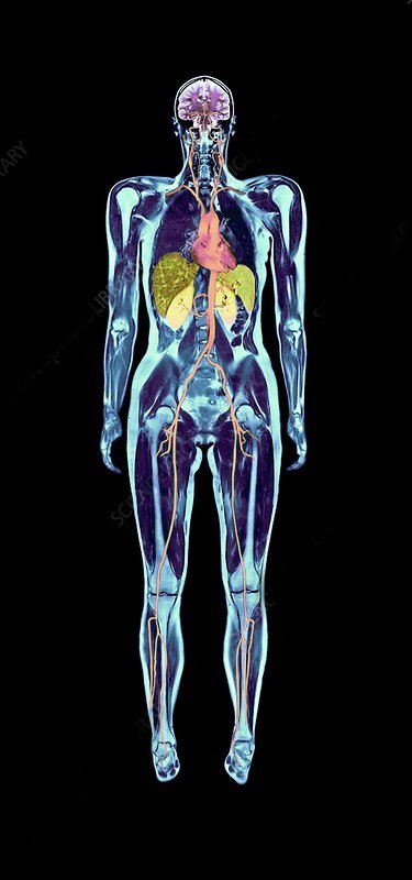 Full Body Scan (MRI | MRI Scans London